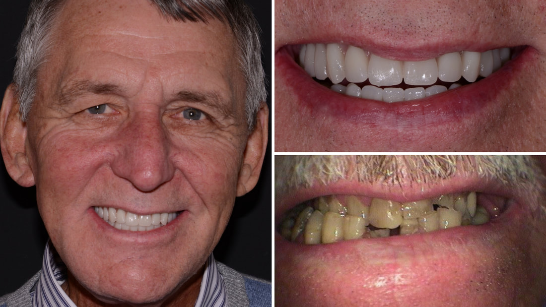 dental before and after